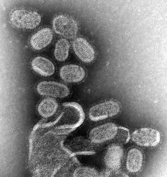 вирус испанского гриппа под микроскопом