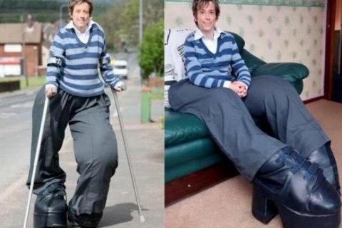 Синдром Протея. Редкая болезнь и судьба Мэнди Селларс