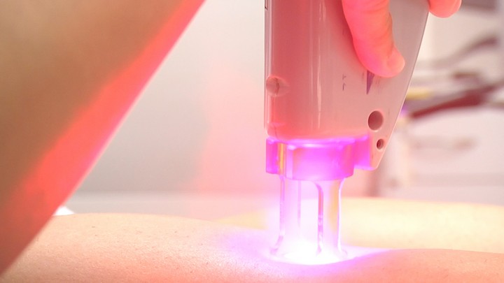 3 менее известных преимущества лазерной эпиляции