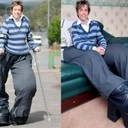 Синдром Протея. Редкая болезнь и судьба Мэнди Селларс