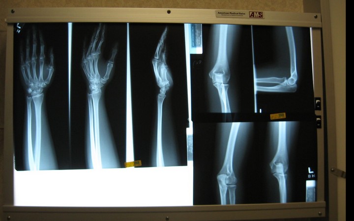 Чем занимается врач-ортопед?