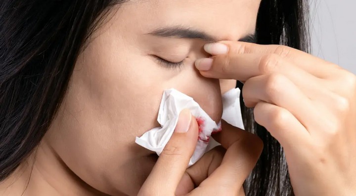 носовое кровотечение