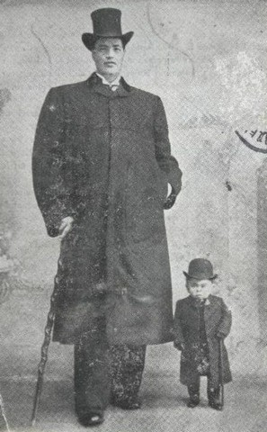 гигант и карлик гигант и карлик