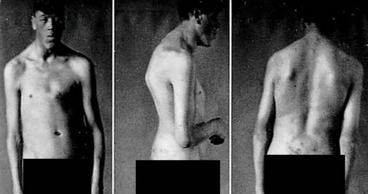 ухудшение состояния ухудшение состояния