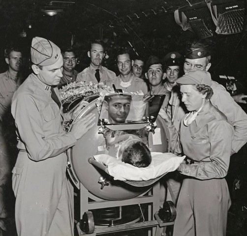 железные легкие и их история железные легкие и их история