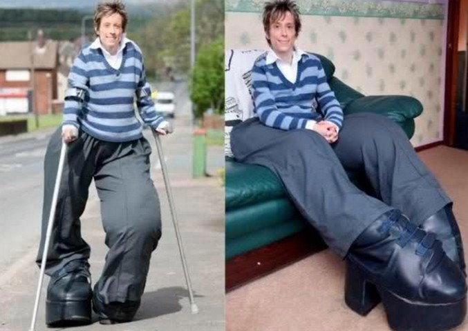 синдром протея