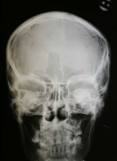 бункер в Будапеште