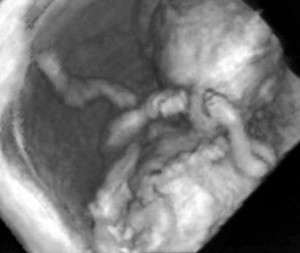 эмбрион примерно на 12 неделе