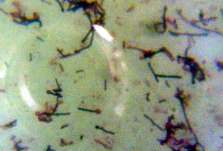 Бактерия Clostridium tetani