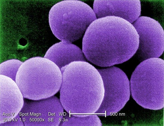 Колонии Staphylococcus aureus
