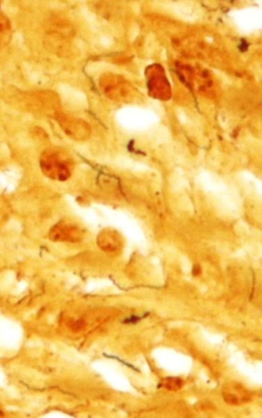 Спиралевидная бактерия Treponema pallidum