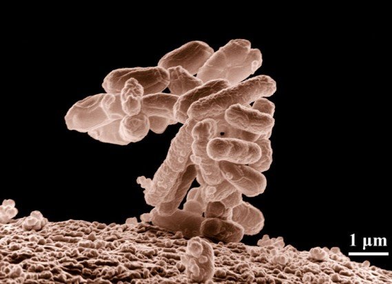 Опасные штаммы Escherichia coli