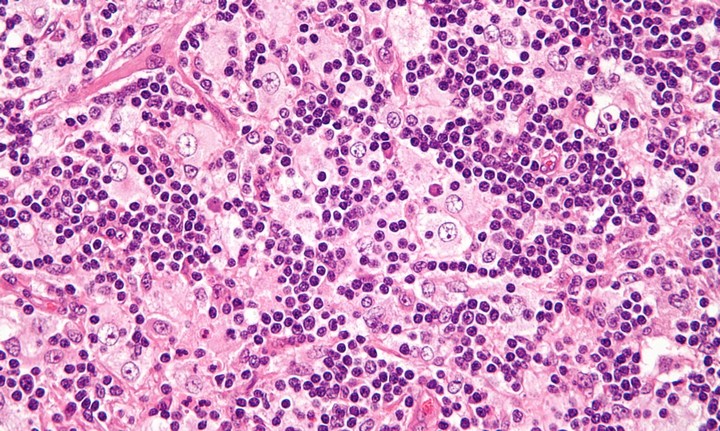 Фото Риск массовых заболеваний