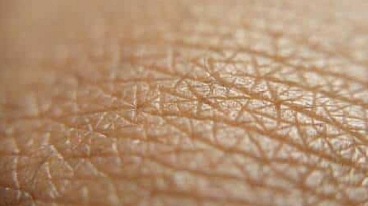 Фото Кожа покрыта слоем кислоты