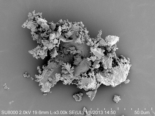 Фото Аллергия на собственную кожу